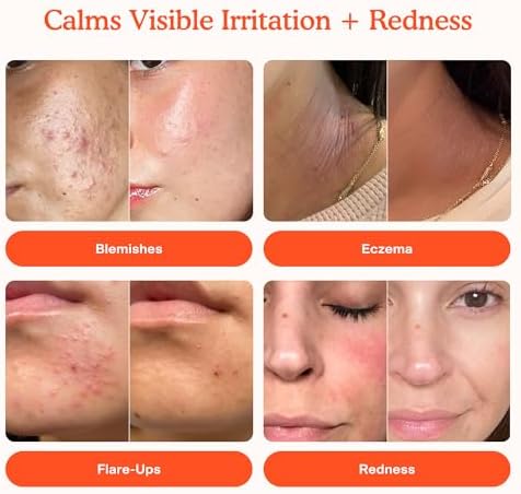 Tower 28 SOS Daily Rescue Facial Spray for Sensitive Skin, Hypochlorous Acid Spray Helps Reduce Redness and Breakouts, Travel Size Toner for Face, 1 FL Oz - Image 2