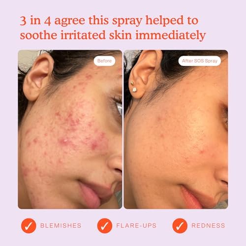 Tower 28 SOS Daily Rescue Facial Spray for Sensitive Skin, Hypochlorous Acid Spray Helps Reduce Redness and Breakouts, Travel Size Toner for Face, 1 FL Oz - Image 4